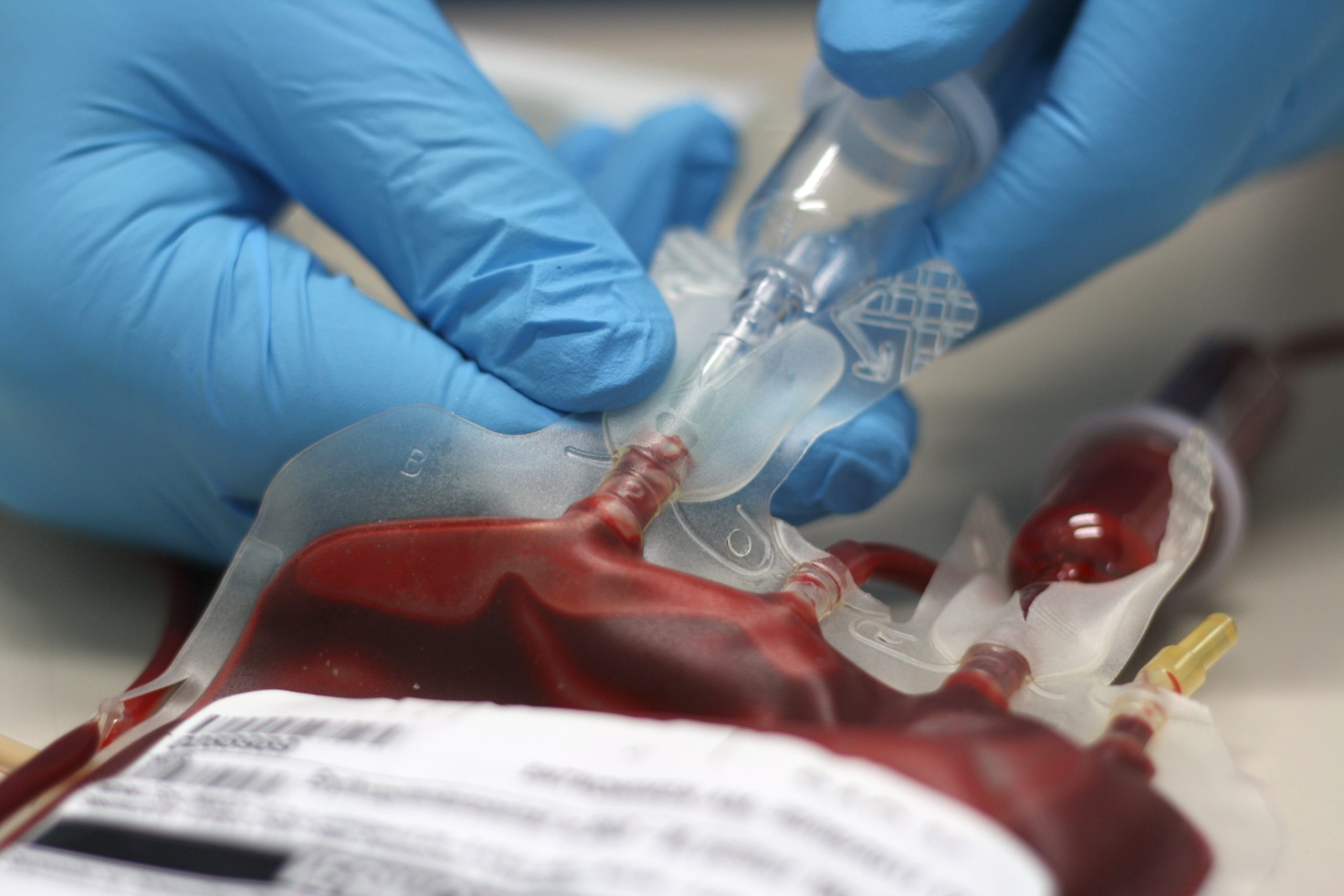 红细胞输血